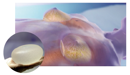 blob.png