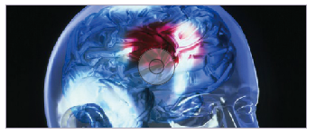 blob.png