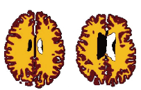 blob.png
