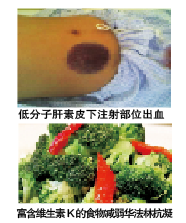 blob.png