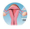 blob.png