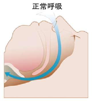 blob.png