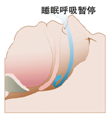 blob.png