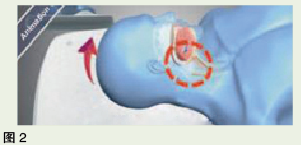 blob.png