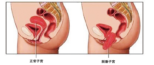 blob.png