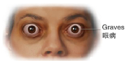 blob.png