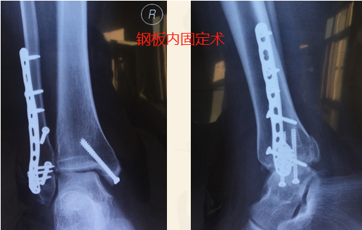 图片17.png