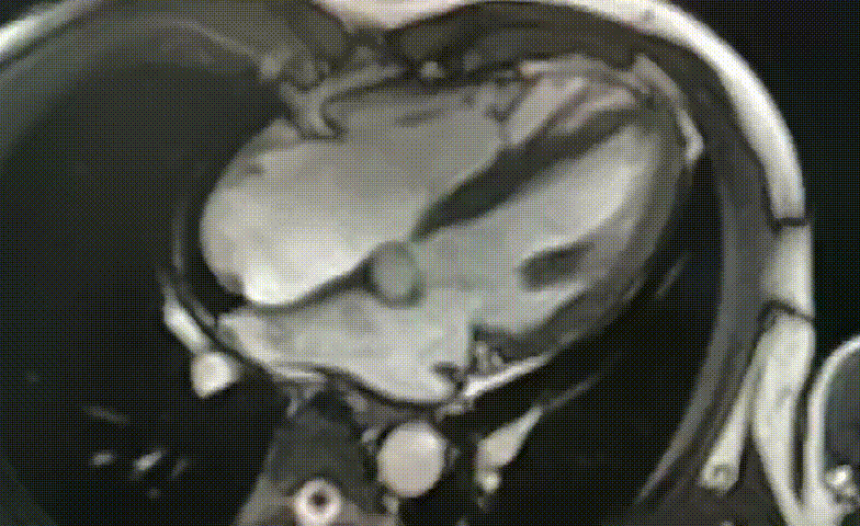 心脏电影序列2.gif