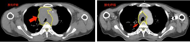 3102d10b5762451c935d76f7bc05b3d3.png