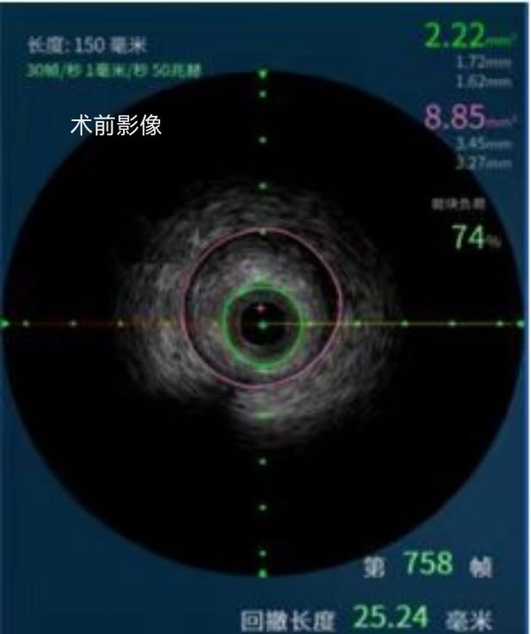 微信图片_20250627102337.jpg