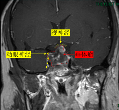 29512c3d-bb25-4516-8992-a16097afbe6c.png
