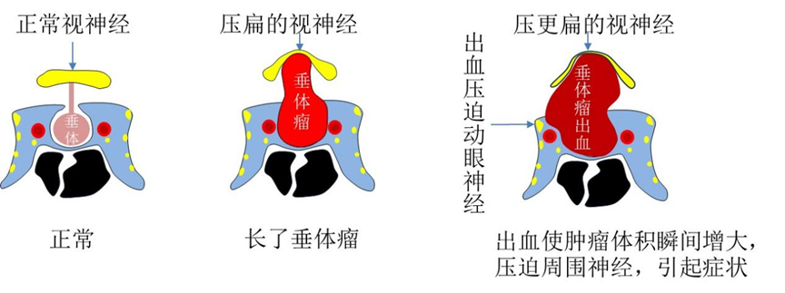be6bcbb309334218e01964e584222ed1.png